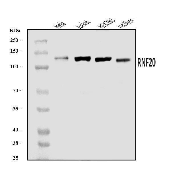 Anti-RNF20 Antibody Picoband® Boster Bio