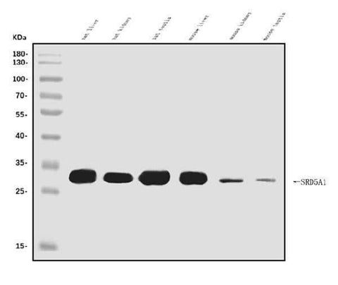 Anti-SRD5A1 Antibody Picoband® Boster Bio