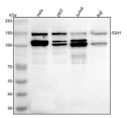 Anti-SSH1 Antibody Picoband® Boster Bio
