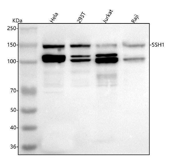 Anti-SSH1 Antibody Picoband® Boster Bio