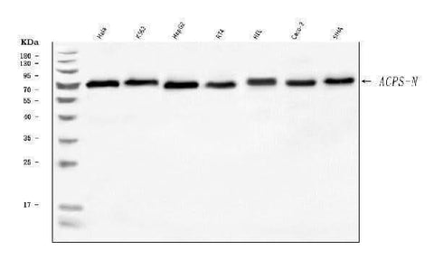 Anti-AGPS Antibody Picoband® Boster Bio