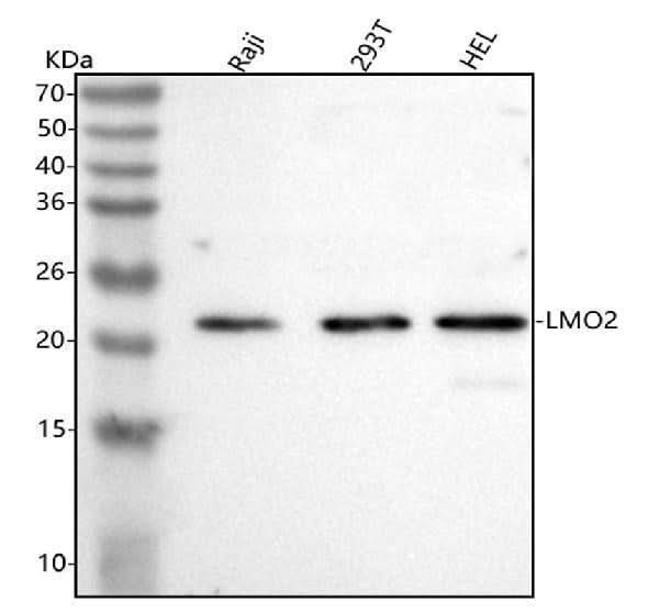 Anti-LMO2 Antibody Picoband® Boster Bio