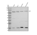 Anti-HHIP Antibody Picoband® Boster Bio