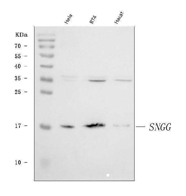 Anti-gamma Synuclein/SNCG Antibody Picoband® Boster Bio