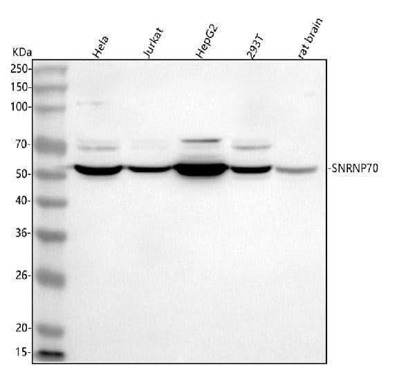 Anti-SNRNP70 Antibody Picoband® Boster Bio