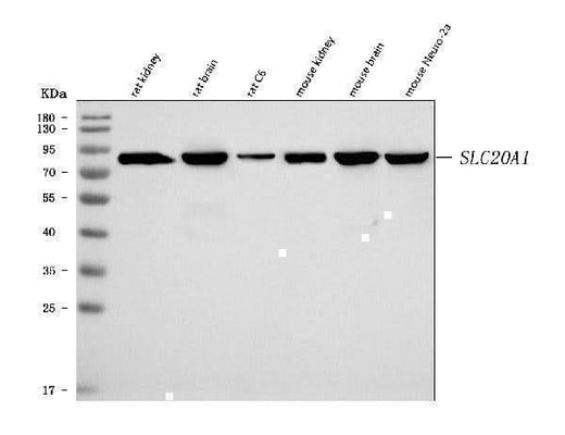 Anti-SLC20A1 Antibody Picoband® Boster Bio