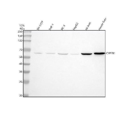 Anti-CYP7B1 Antibody Picoband® Boster Bio