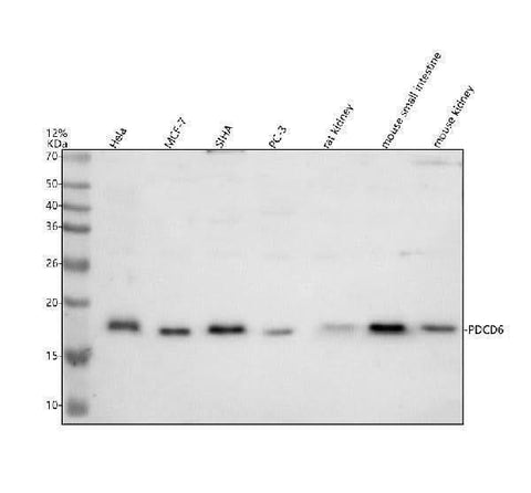 Anti-ALG2/PDCD6 Antibody Picoband® Boster Bio