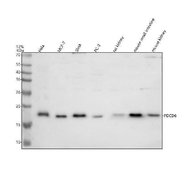 Anti-ALG2/PDCD6 Antibody Picoband® Boster Bio