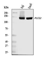 Anti-PLCG 2/PLCG2 Antibody Picoband® Boster Bio
