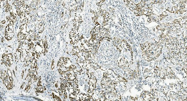 Anti-IL37 Antibody Boster Bio