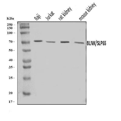 Anti-BLNK Antibody Picoband® Boster Bio