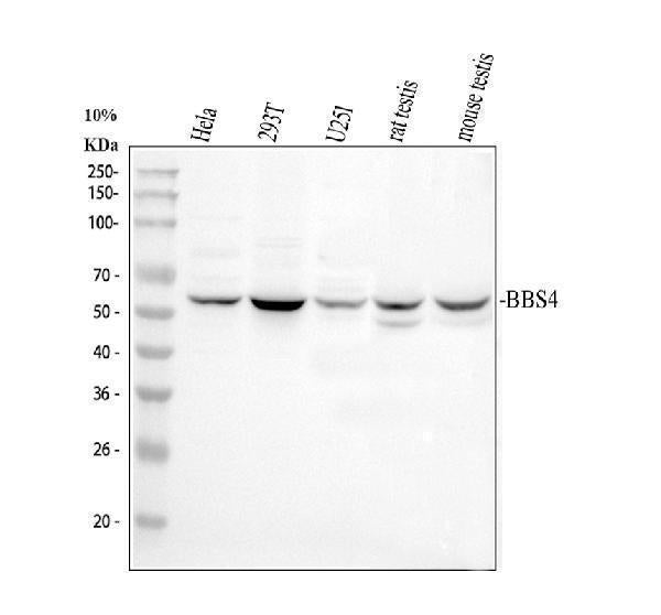 Anti-BBS4 Antibody Picoband® Boster Bio