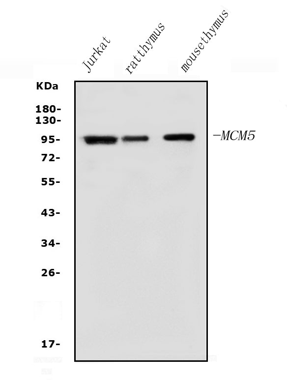Anti-MCM5 Antibody Picoband® Boster Bio
