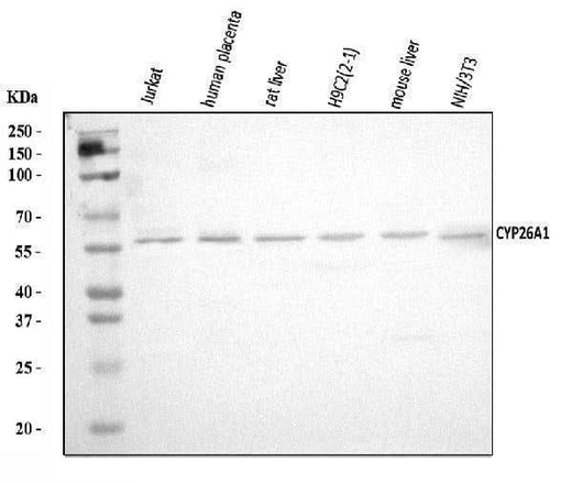 Anti-CYP26A1 Antibody Picoband® Boster Bio