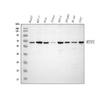 Anti-METAP2 Antibody Picoband® Boster Bio
