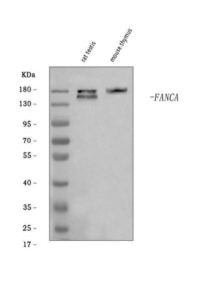 Anti-Fanca/FAA Antibody Picoband® Boster Bio