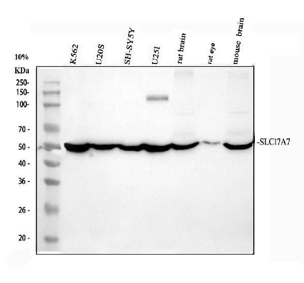 Anti-VGLUT1/SLC17A7 Antibody Picoband® Boster Bio