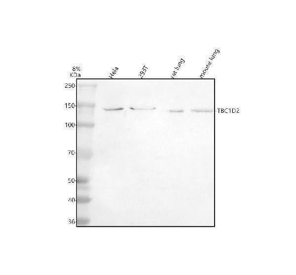 Anti-TBC1D1 Antibody Picoband® Boster Bio