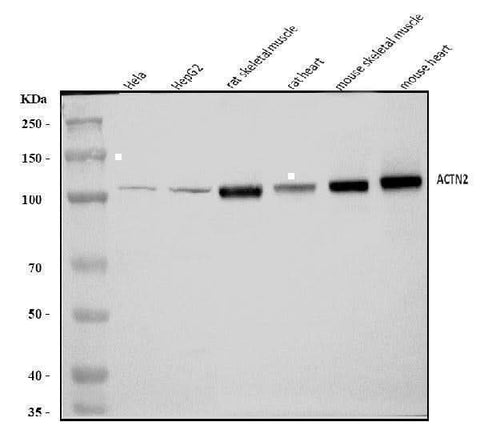 Anti-ACTN2 Antibody Picoband® Boster Bio