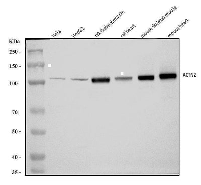Anti-ACTN2 Antibody Picoband® Boster Bio