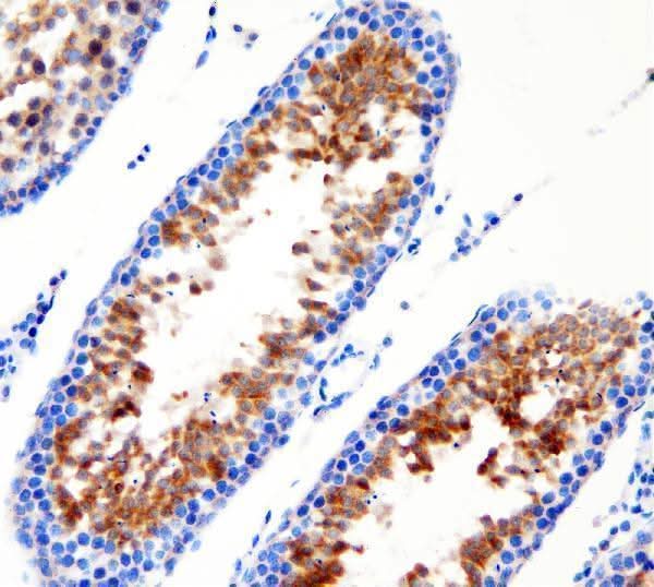 Anti-DDX1 Antibody Picoband® Boster Bio
