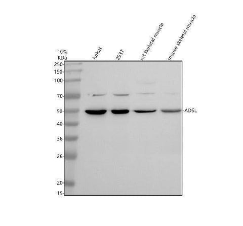 Anti-ADSL Antibody Picoband® Boster Bio