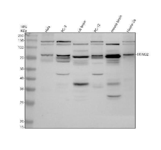 Anti-TRIM32 Antibody Picoband® Boster Bio