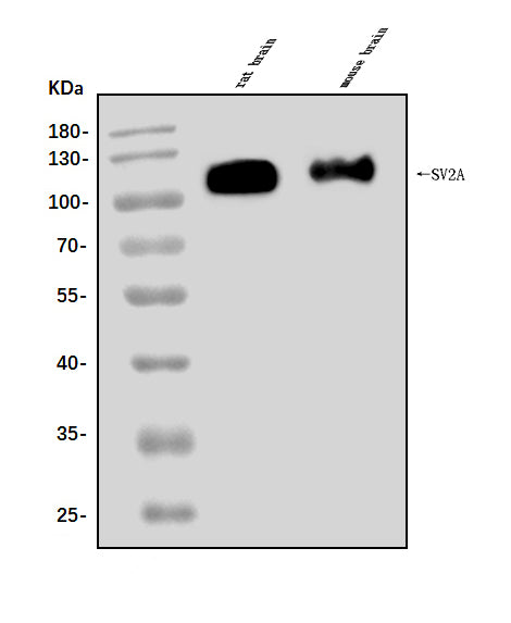 Anti-SV2A Antibody Picoband® Boster Bio