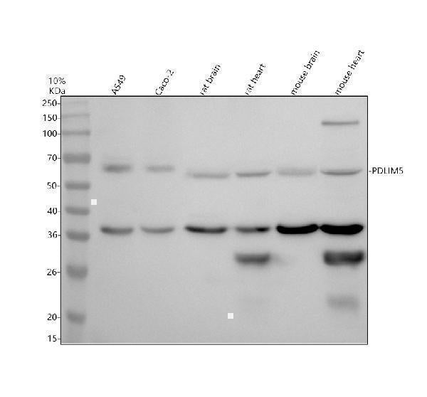 Anti-PDLIM5 Antibody Picoband® Boster Bio