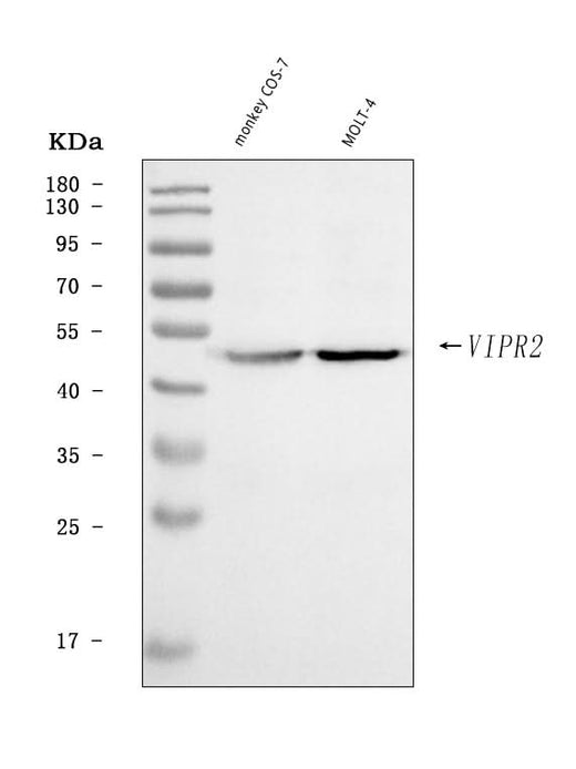 Anti-VPAC2/VIPR2 Antibody Picoband® Boster Bio