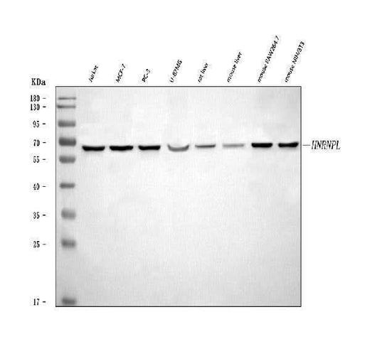 Anti-hnRNP L/HNRNPL Antibody Picoband® Boster Bio