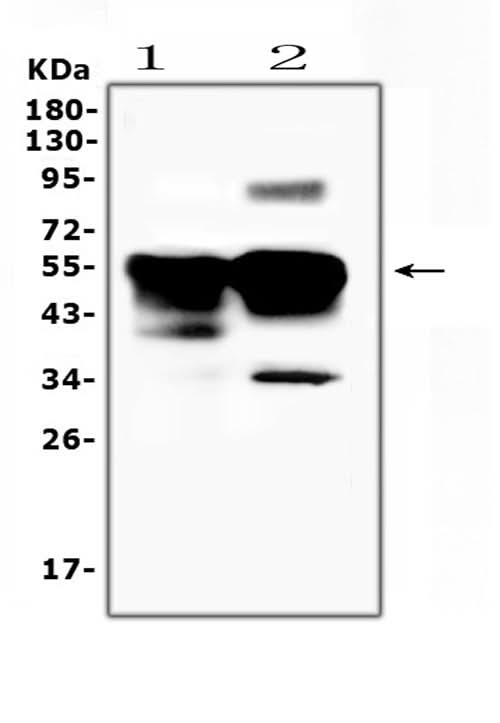 Anti-Retinal S antigen/SAG Antibody Picoband® Boster Bio