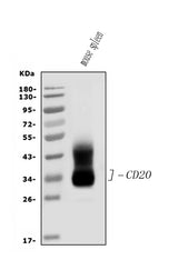 Anti-CD20/MS4A1 Antibody Picoband® Boster Bio