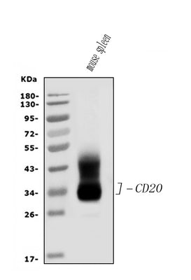 Anti-CD20/MS4A1 Antibody Picoband® Boster Bio
