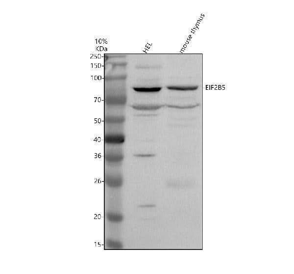 Anti-EIF2B5 Antibody Picoband® Boster Bio