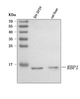 Anti-RBP1 Antibody Picoband® Boster Bio