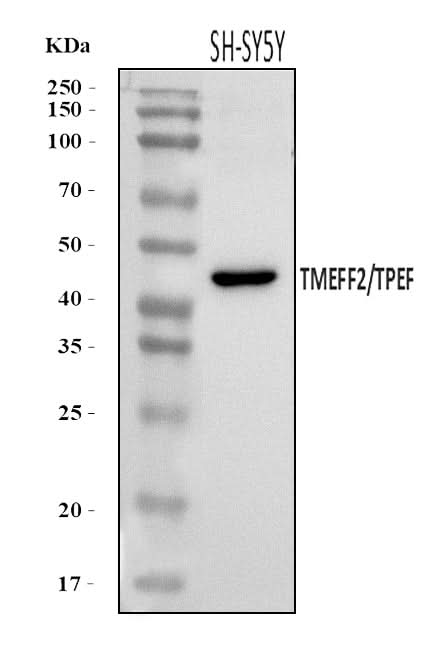 Anti-TMEFF2 Antibody Picoband® Boster Bio