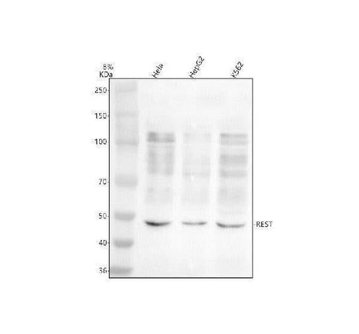 Anti-REST Antibody Picoband® Boster Bio