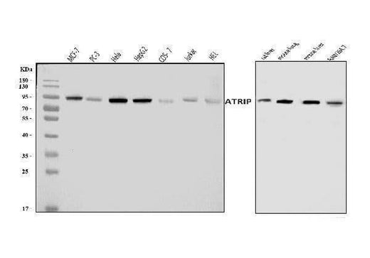 Anti-ATRIP Antibody Picoband® Boster Bio