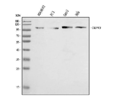 Anti-TRPV3 Antibody Picoband® Boster Bio