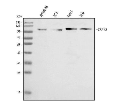 Anti-TRPV3 Antibody Picoband® Boster Bio