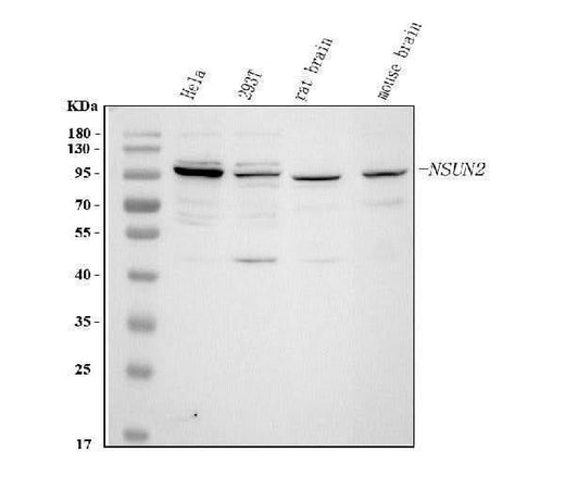 Anti-NSUN2 Antibody Picoband® Boster Bio