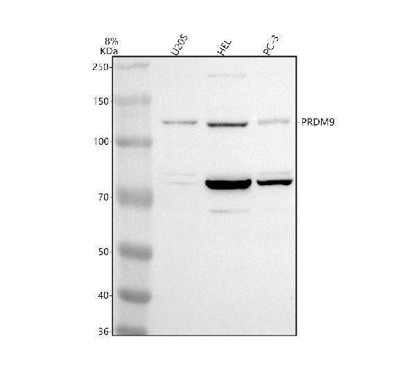 Anti-PRDM9 Antibody Picoband® Boster Bio