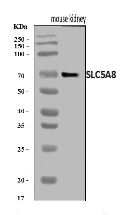 Anti-SLC5A8 Antibody Picoband® Boster Bio