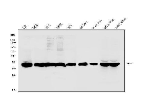 Anti-Aldolase/ALDOB Antibody Picoband® Boster Bio
