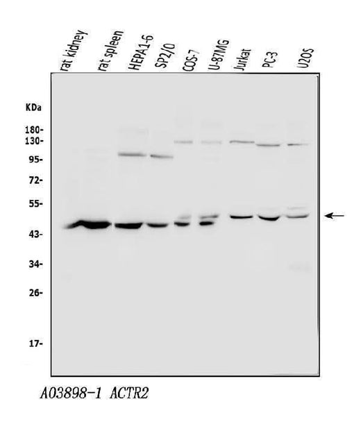Anti-Arp2/ACTR2 Antibody Picoband® Boster Bio