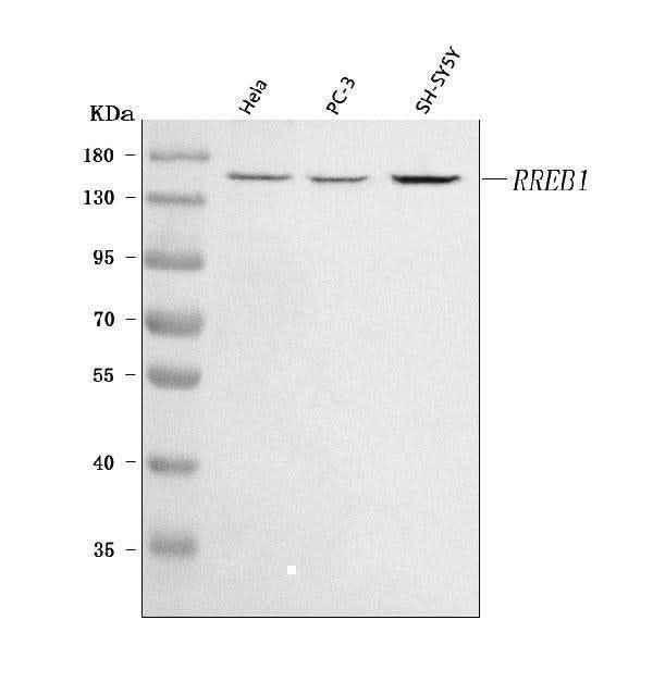 Anti-RREB1 Antibody Picoband® Boster Bio