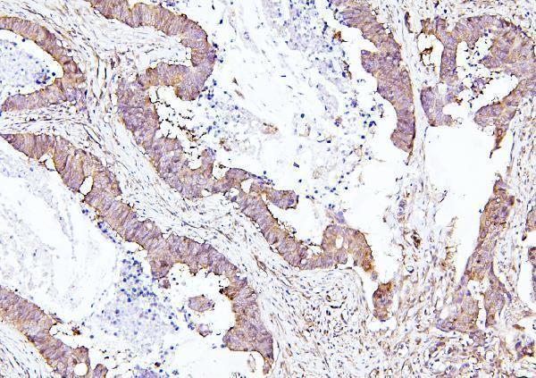 Anti-EIF4A1/2/3 Antibody Picoband® Boster Bio
