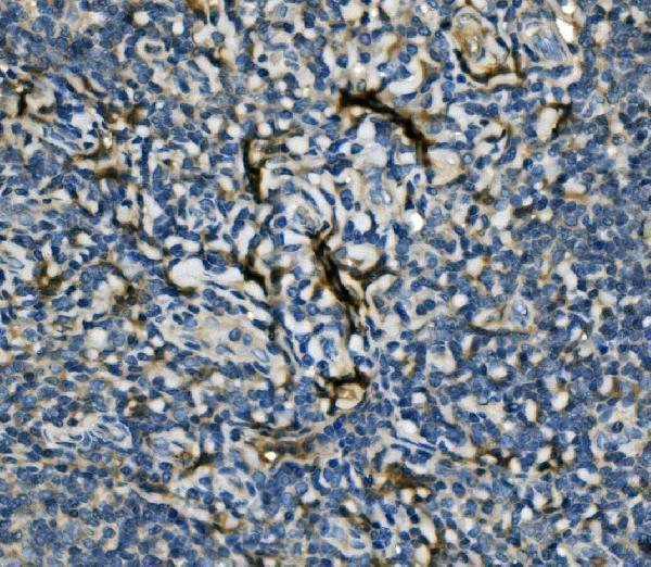 Anti-EIF4A1 Antibody Picoband® Boster Bio